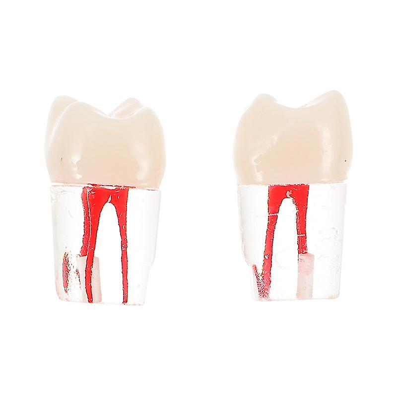 2pcs Teeth Root Canal Filling Model