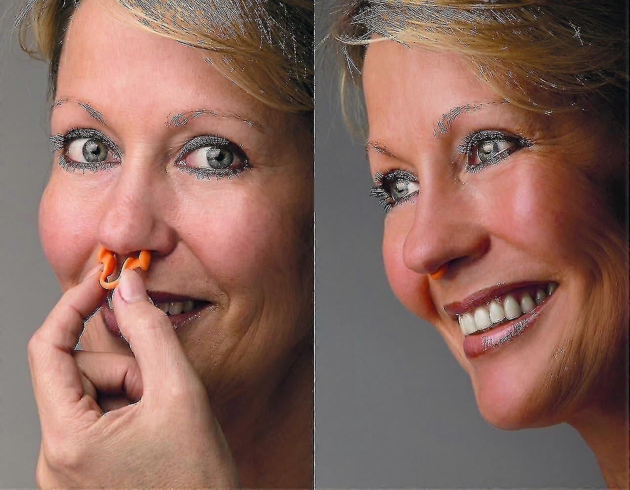 3pcs Anti Snoring Nasal Dilator Transparent - Nose Breathing Middle - Nasal Congestion Prevention