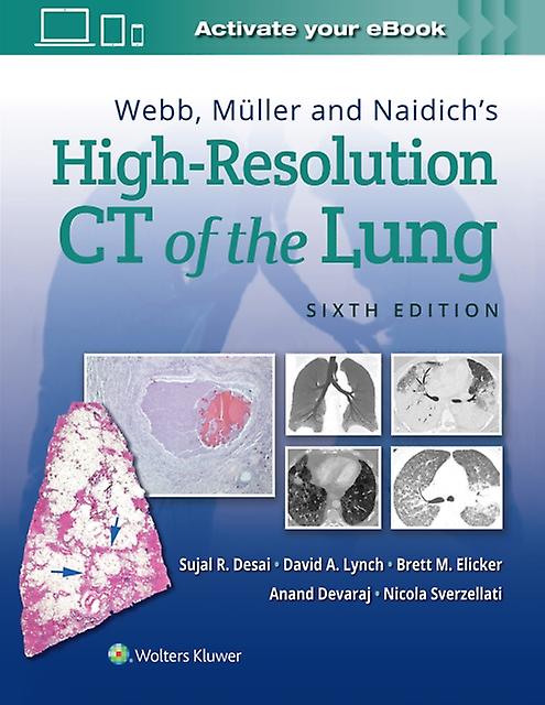 Webb Muller And Naidichs Highresolution Ct Of The Lung by Nicola Sverzellati Paperback Book