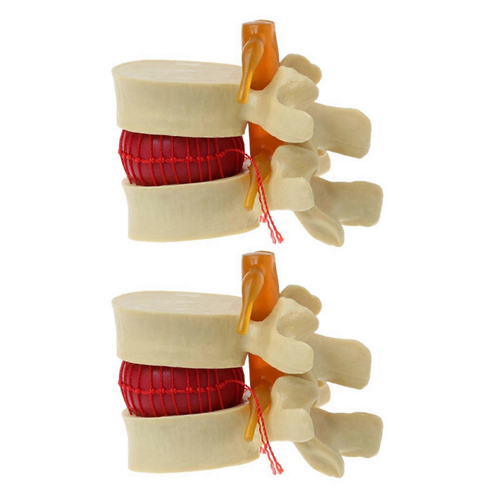 2X Lumbar Vertebrae Model Anatomical Spine Lumbar Disc Herniation Anatomy Teaching Tool Lumbar Verte