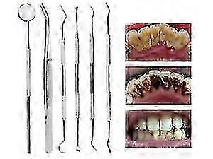 Dental Cleaning Set for Removing Stains and Calculus