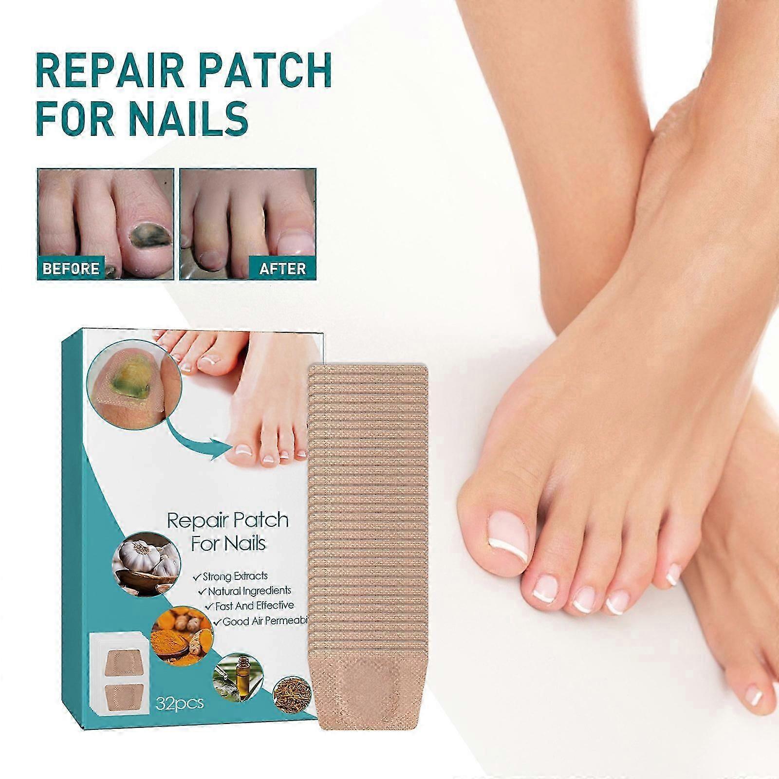 Patch de réparation pour les ongles, Patchs de réparation d’ongles Ongles incrustés d’orteils, Patch d’ongle épaississant Réparation d’onychomycose Patchs d’ongles