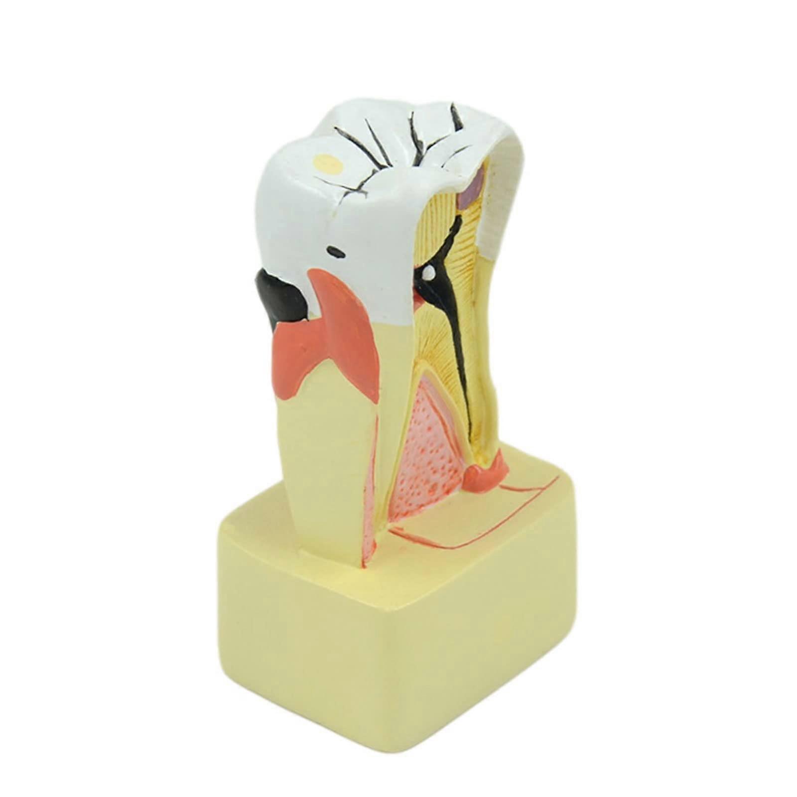 Dental Tooth Model PVC Periodontal Disease Model with Clear 3D Visualization for Dentist Teaching