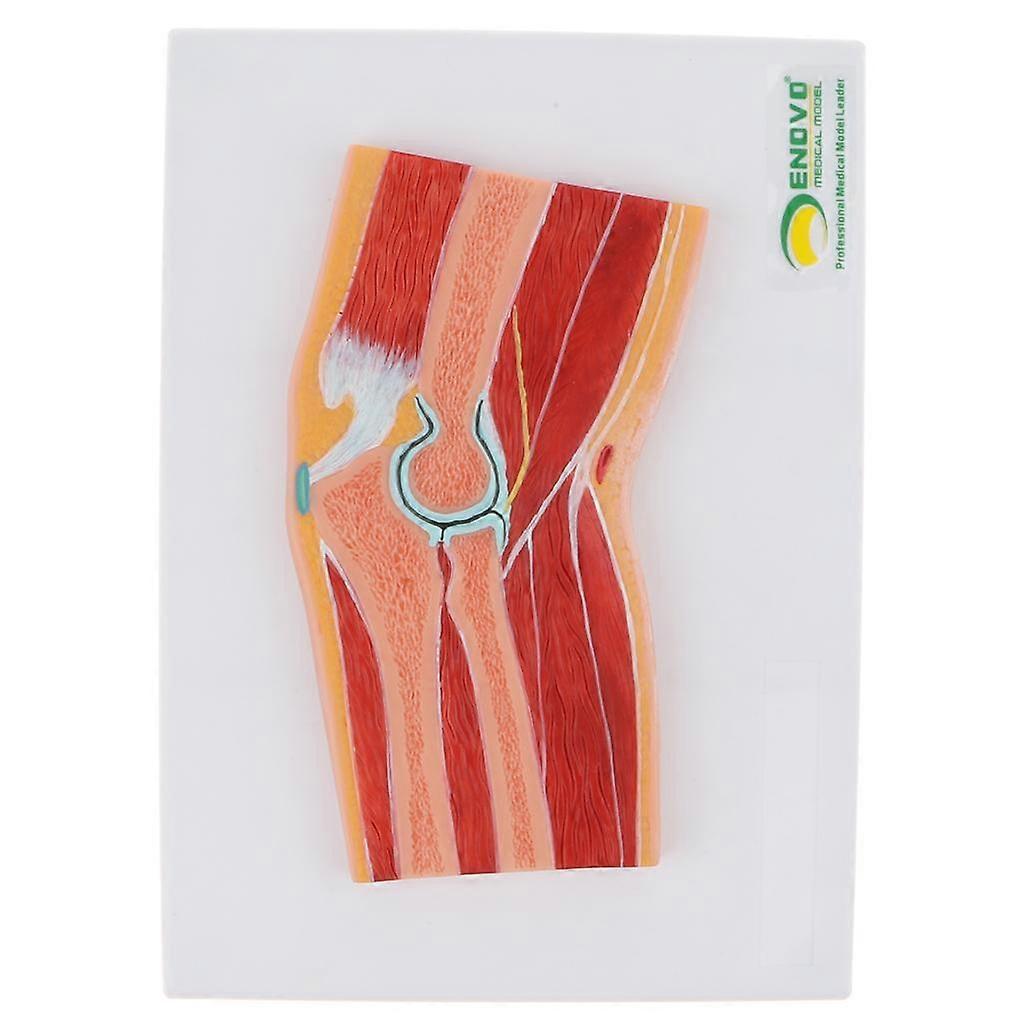 1:1 等身大 PVC 人間肘関節筋肉 MRI セクション モデル ラボ用品