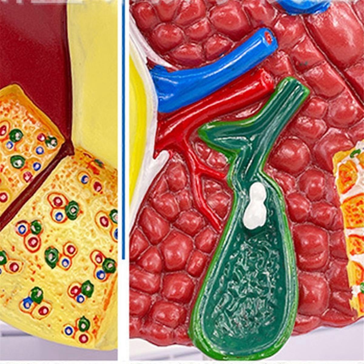 Liver Model for Common Pathologies, Liver Model Human Anatomy