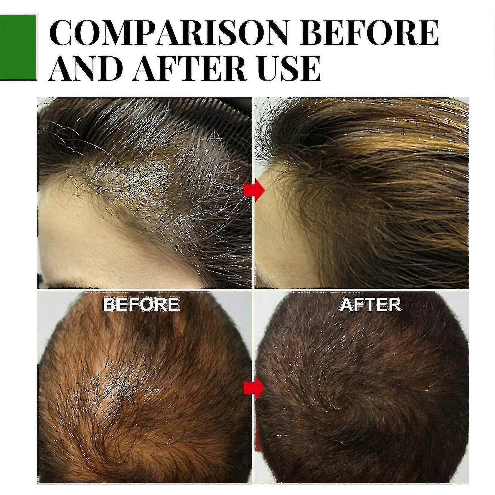 زيت إكليل الجبل يغذي ويصلح ويحسن الأطراف المتقصفة ويهتم بالشعر ويزيل الحكة والجفاف في فروة الرأس صندوق 30 مل