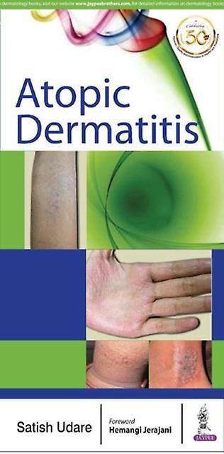Atopic Dermatitis - Satish Udare