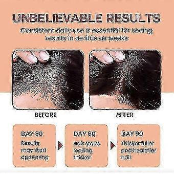 1-3x Rohes Batanaöl für Haarwachstum - Reines, biologisches Batana aus Honduras für dickes und kräftiges Naturhaar - Unraffiniertes, kaltgepresstes Kosmetiköl