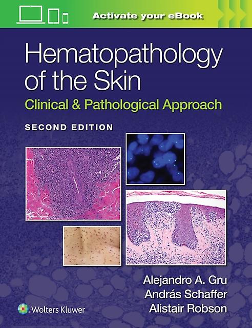 Hematopathology Of The Skin by ALISTAIT ROBSON Paperback Book