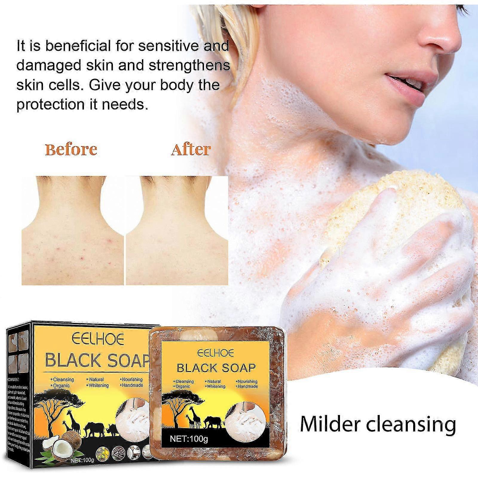 Eelhoe Itching And Acne Soap -7399138120524