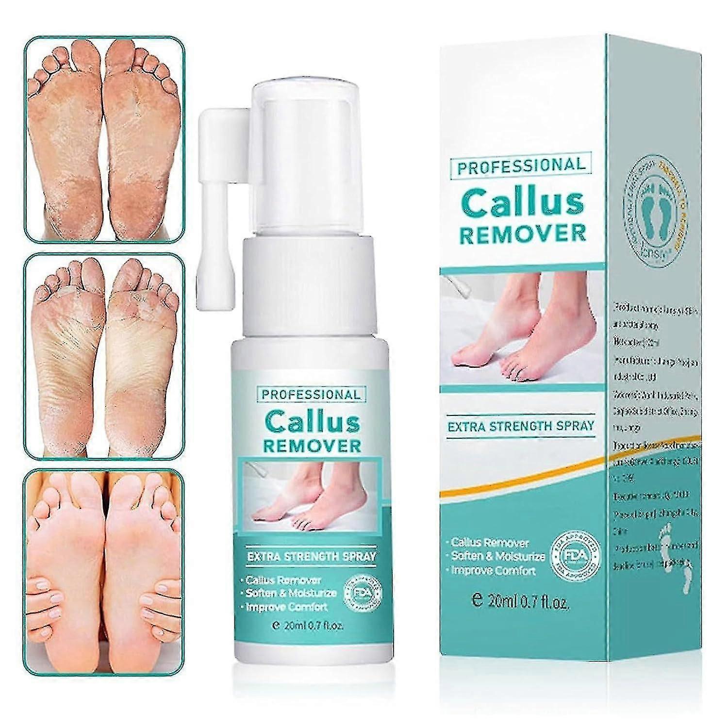 1-3PCS专业去胼胝剂额外强度喷雾，足部胼胝去除喷雾，即时足部剥落喷雾