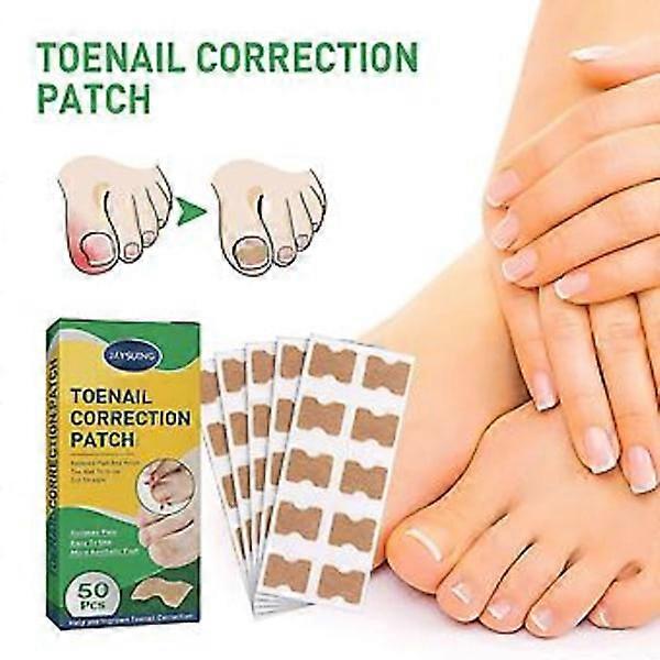 50 Τεμ Toenail Correction Strips, Nail Repair, Ingrown Toenails Correction Strips