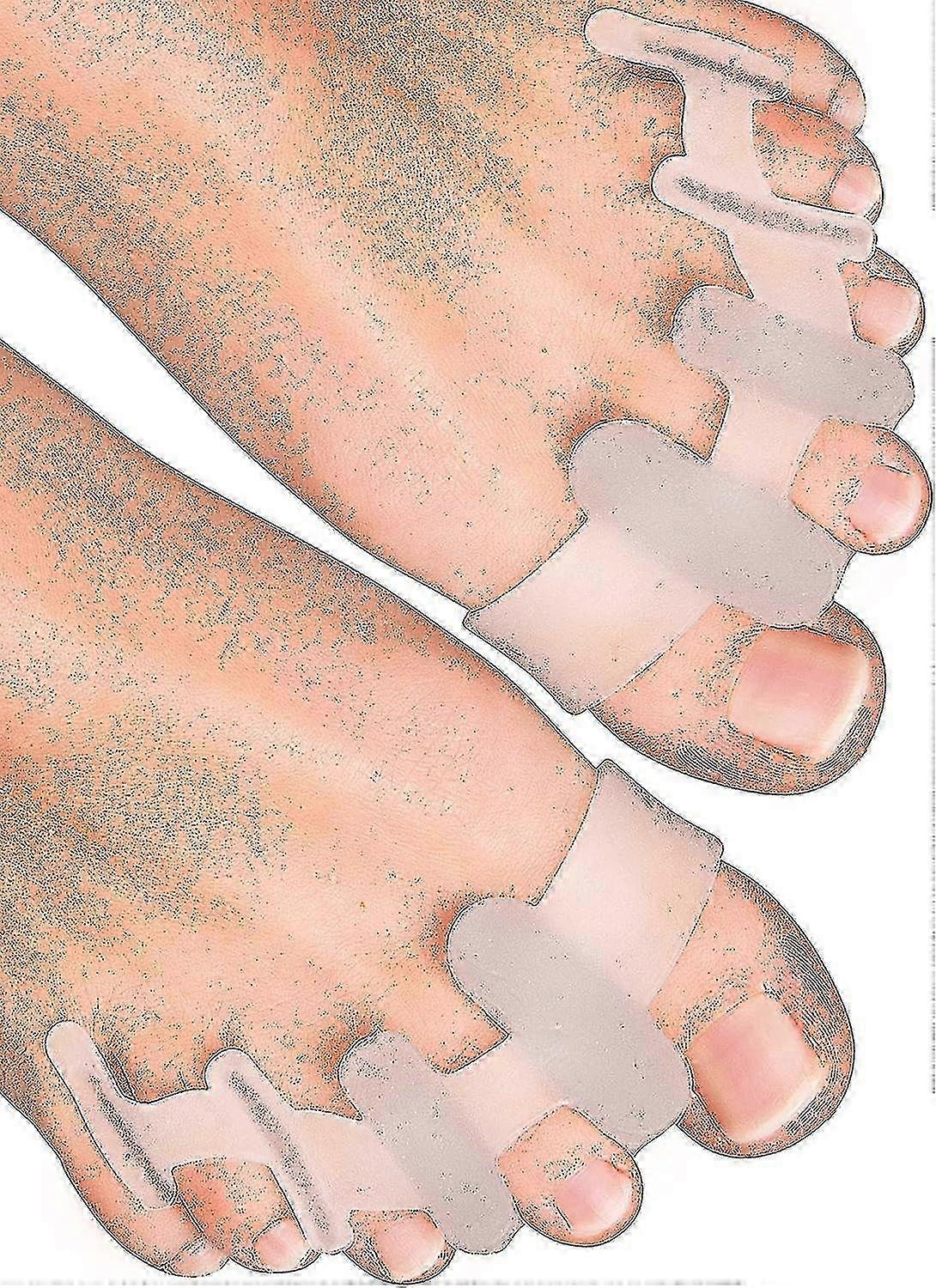 Yogamedic Silicone Toe Separator for Overlapping Toes - 6pcs Bunion Corrector & Toe Straightener, BPA-Free for Relax & Stretch