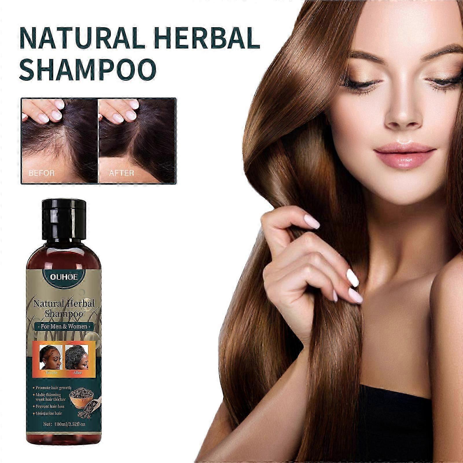 OUHOE shampoo deeply cleanses and massages the scalp, solidifies and nourishes the hair