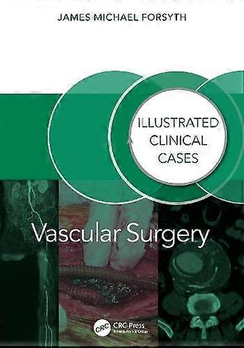 Vascular Surgery by James Forsyth Paperback