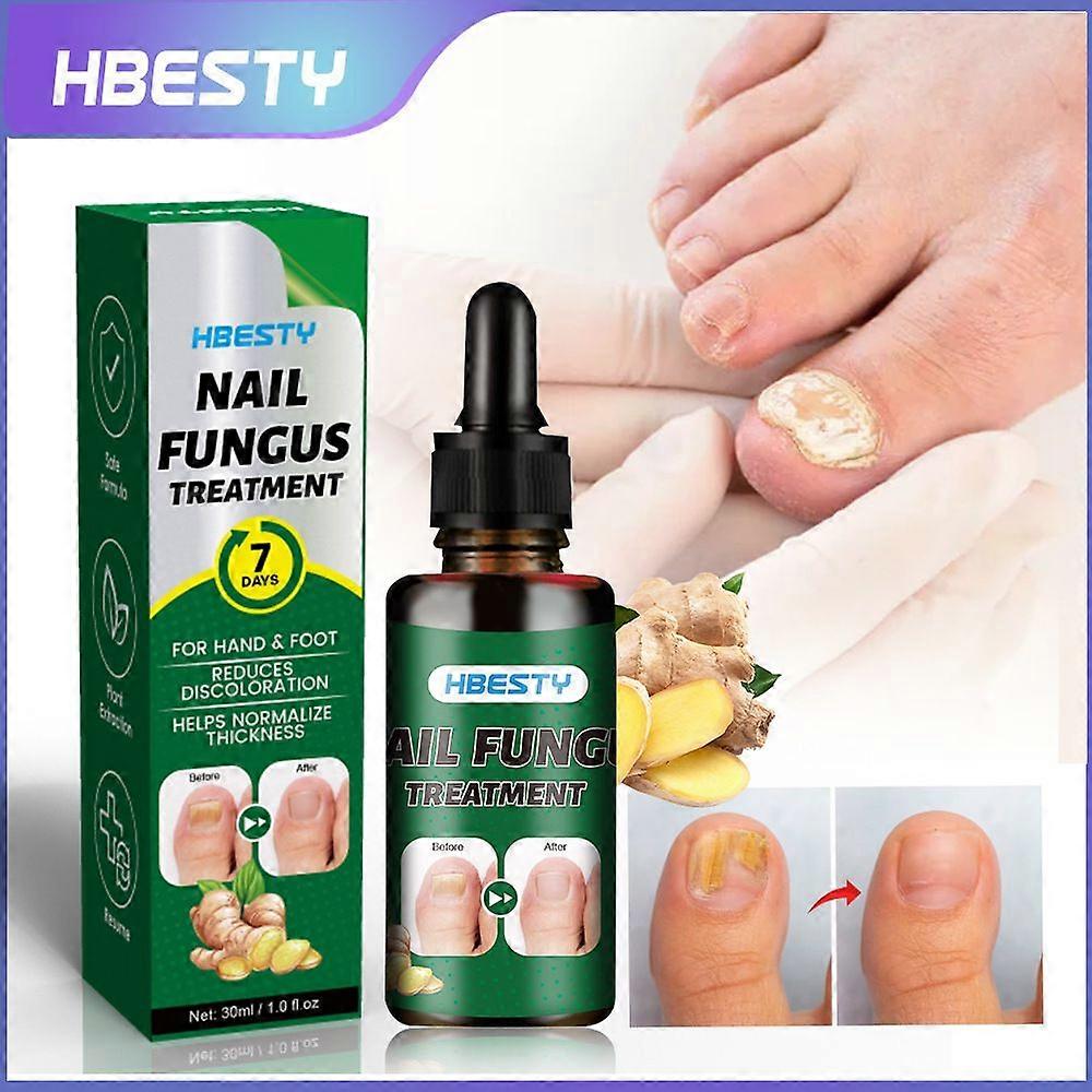 Tratamento de Unhas dos Pés Força Extra, Tratamento de Unhas de Gengibre Suporte de Unhas Cuidados com as Unhas, Tratamento de Unhas de 7 Dias, Fortalecedor de Nutrientes para Unhas de Gengibre G