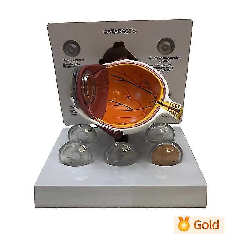 Cornea Eyeball Eye Eye Demonstration Teaching Prop Cataract Anatomy Teaching