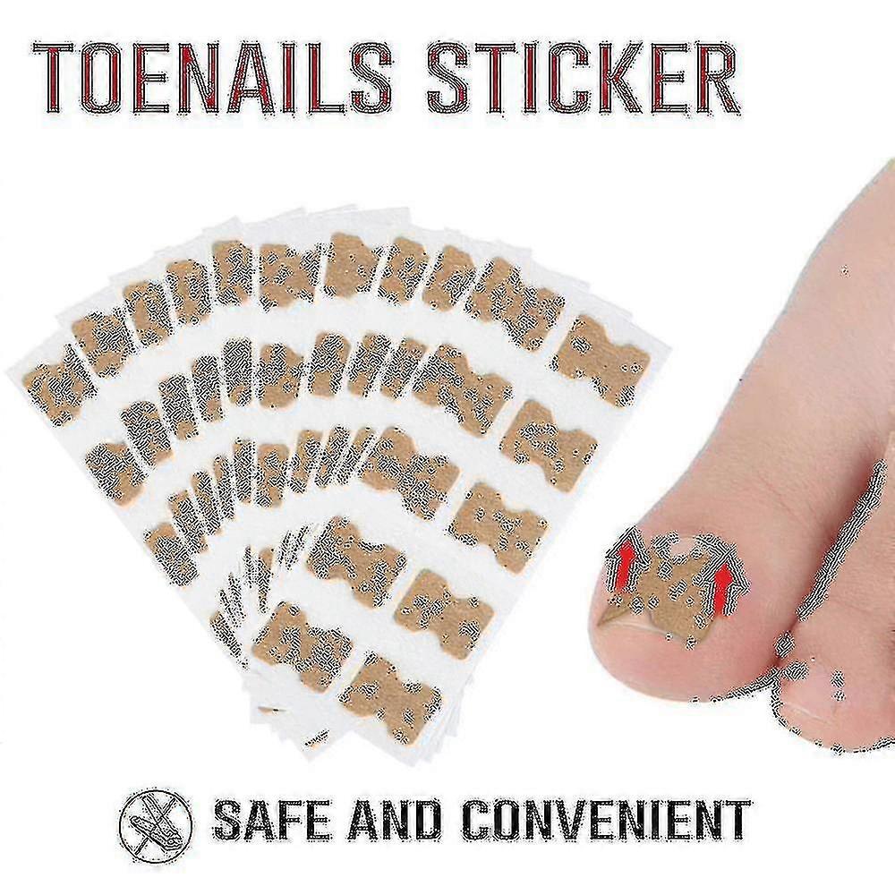 10pcs Toenail Correction Patch Glue Free Pedicure Tools Toe Nail Ingrown Patch Corrector