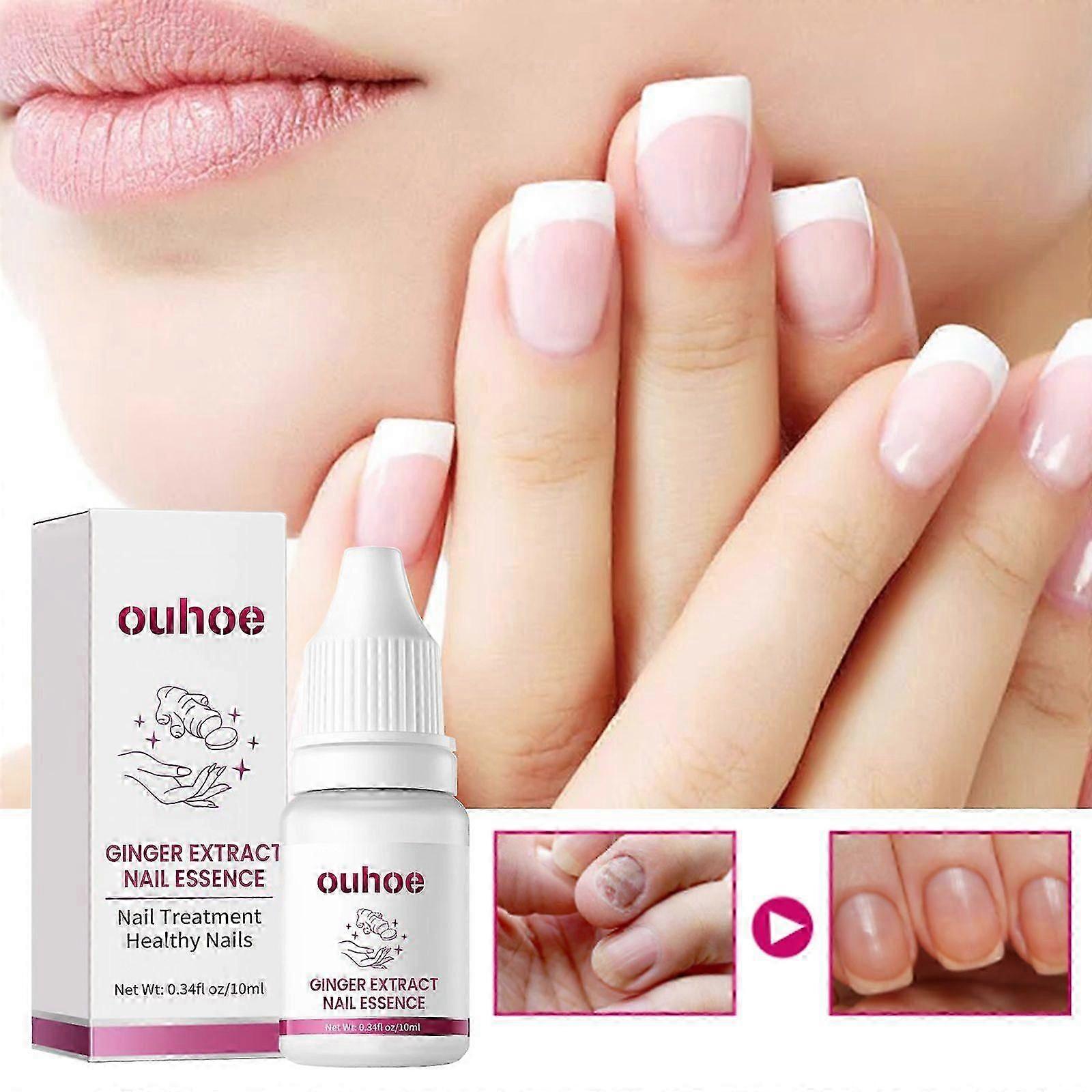 Ginger Nail Care Essence, Gray Nail Moisturizing Care