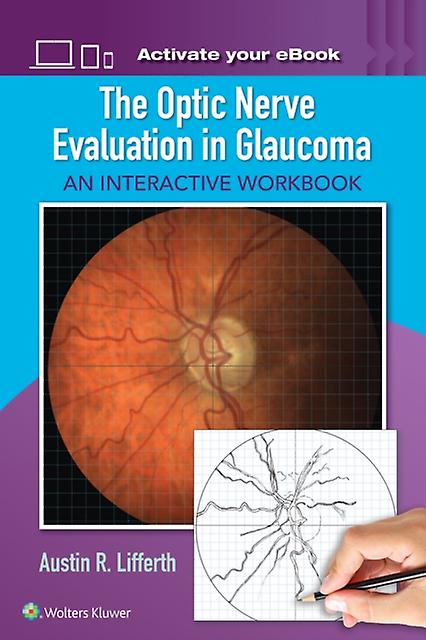 The Optic Nerve Evaluation In Glaucoma by Austin Lifferth Paperback