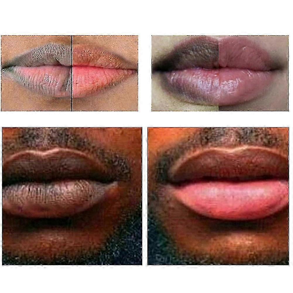 1-3x Lip Lightening Scrub Balm Lightens Lips Hyaluronic 20g