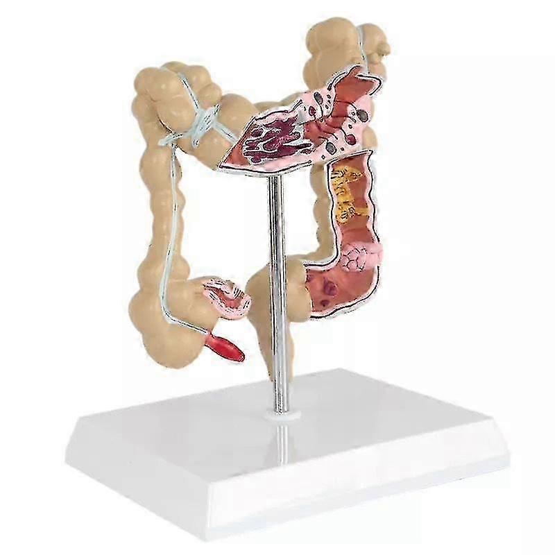 Human model simulation human colon anatomy model anorectal intestinal gastrointestinal digestive system teaching model