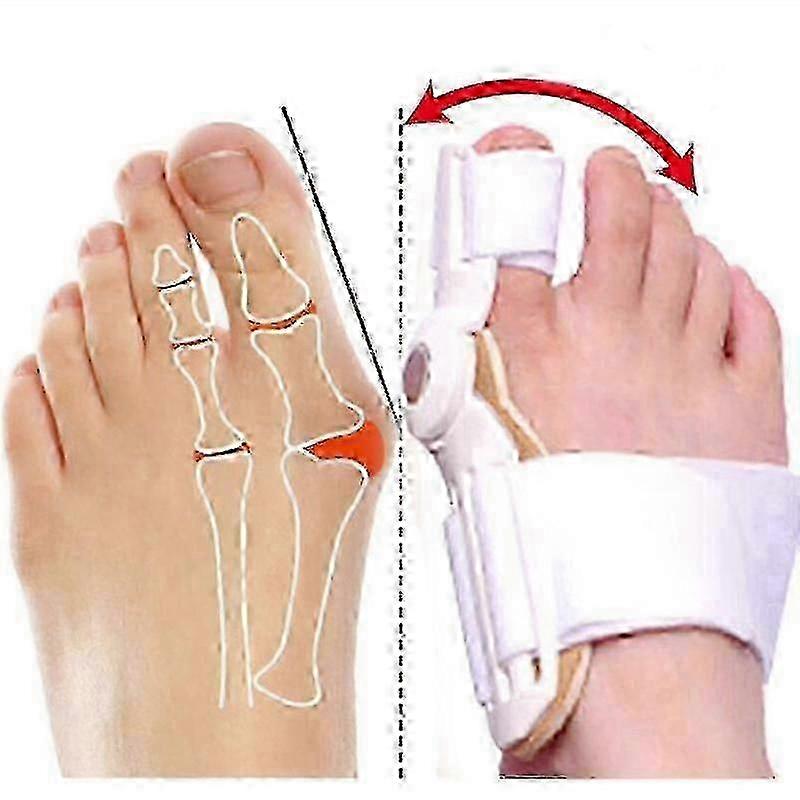 2pcs Splint Big Toe Straightener Corrector Foot Pain Relief Hallux ...