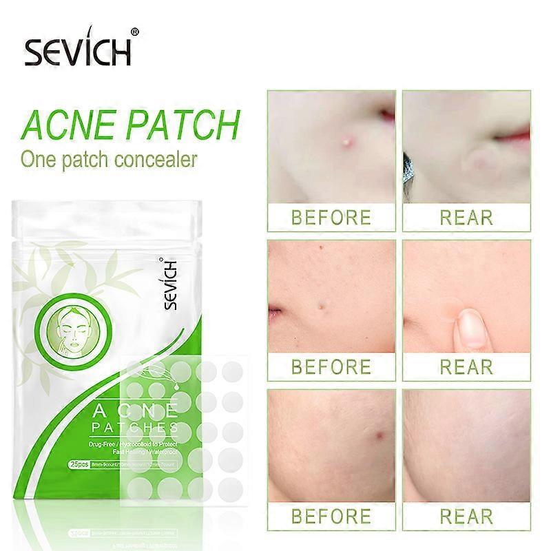 50PCS Beauty Acne tools Hydrocoloid Acne Patch Set Removedor de Marcas Cutáneas Pimple Master Hydrocoloid Patch