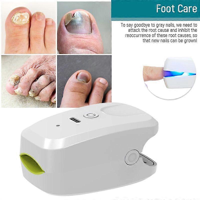 905NM Nail Therapeutic Instrument