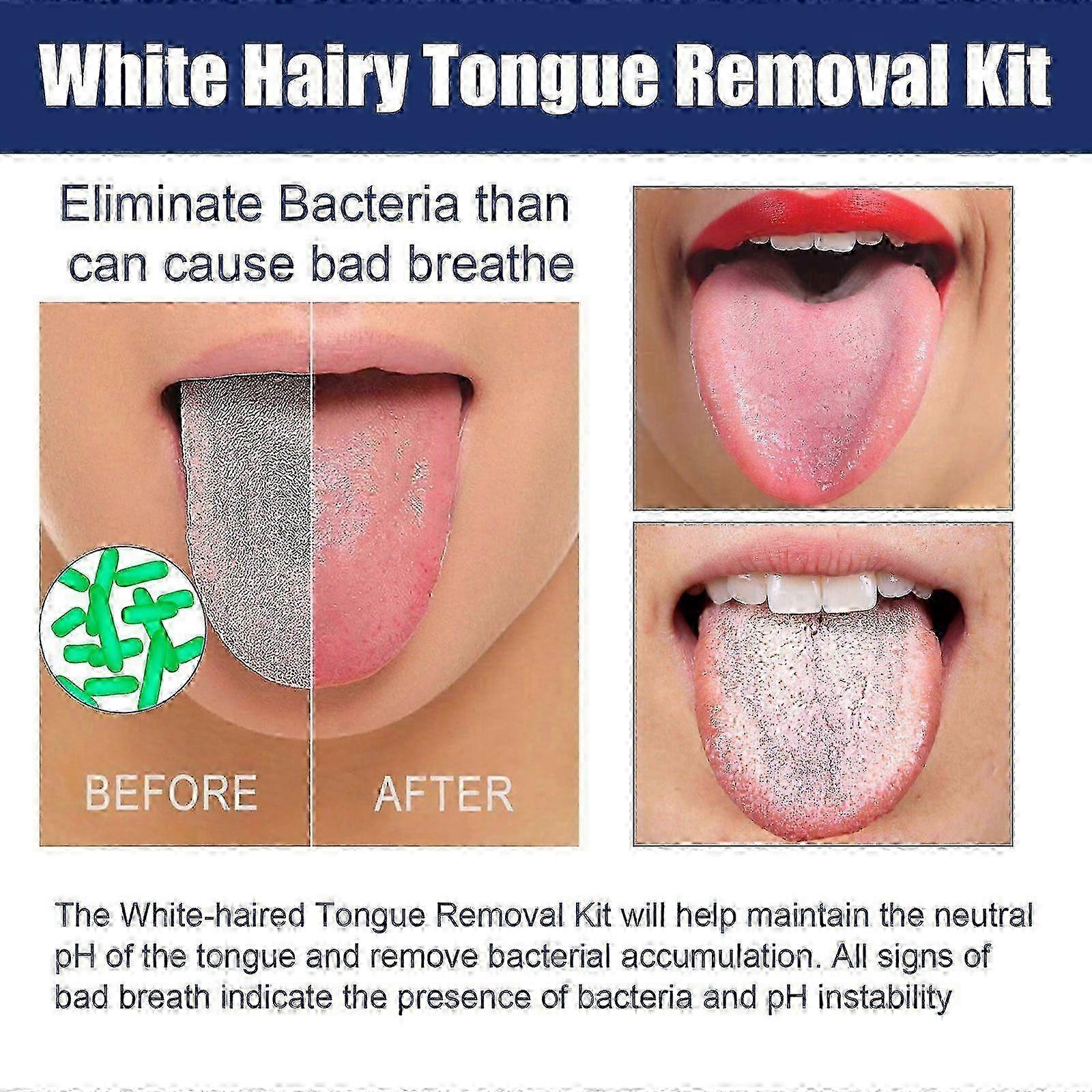 Tongue Coating Removal Kit
