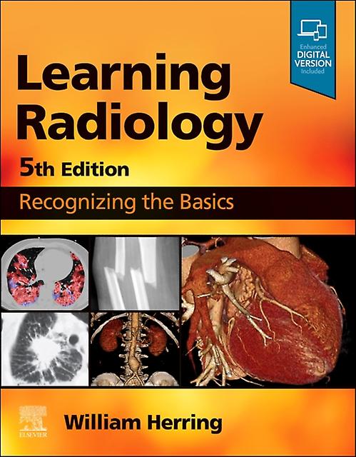 Learning Radiology - Herring, William - Radiology - Elsevier - Health Sciences Division - Paperback