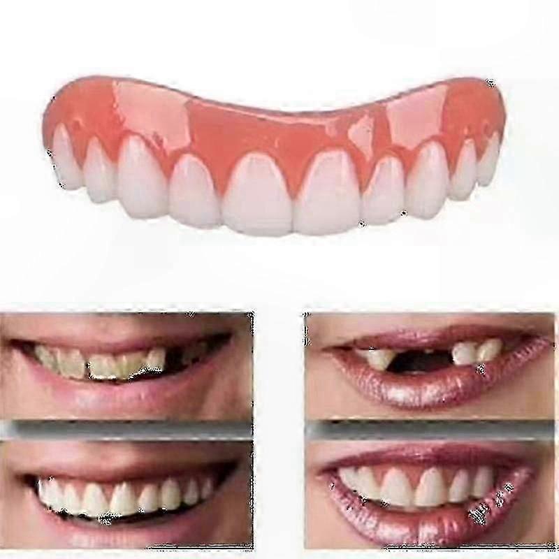 Full Denture Set for Upper and Lower Jaw, Comfortable Fit, Natural Look, Restores Confidence