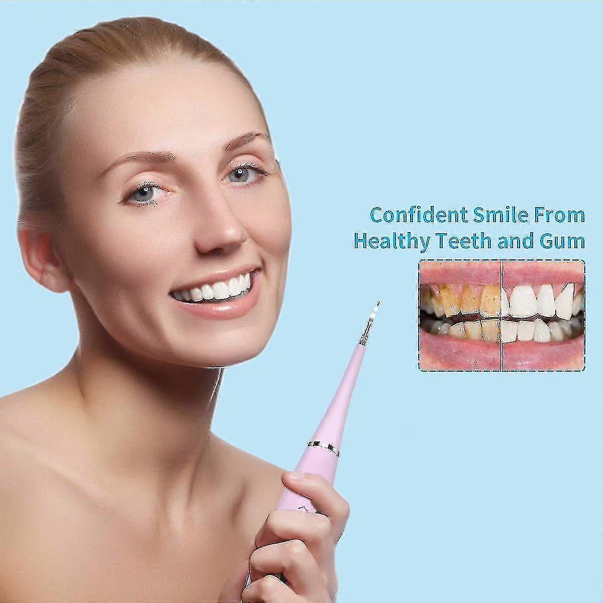 Dental Calculus Remover,electric Portable Tartar Plaque Remover Tartar Scraper Adjustable Modes