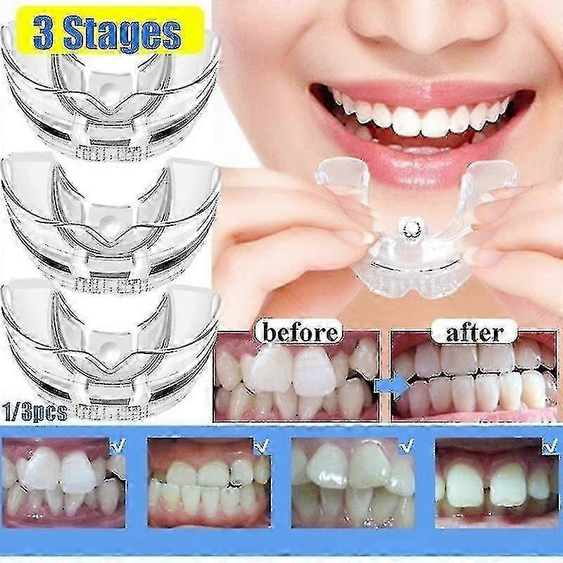 Silicone Teeth Straightening Retainer for Adults
