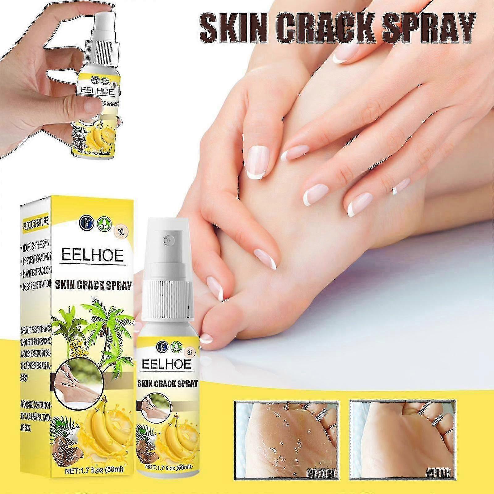 ספריי Skin Crack ספריי בננה קוקוס נגד סדקים פילינג לחות חורפי לרגליים