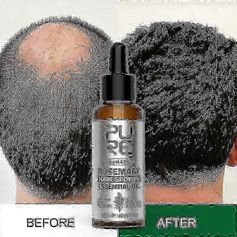 50ml προϊόν ανάπτυξης τρίχας πετρελαίου δεντρολίβανου για τις γυναίκες ανδρών Τζίντζερ αντι τριχόπτωση γρήγορη αναγέννηση πυκνώνει τη θεραπεία τριχωτού της κεφαλής ελαίων