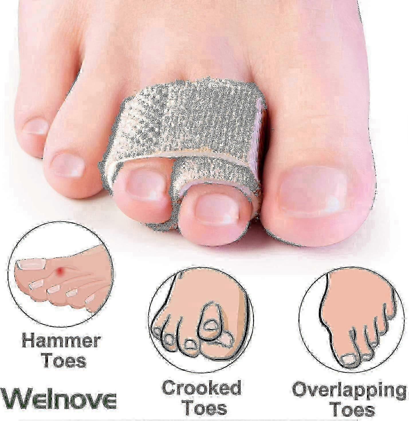 6-Pack Reusable Hammer Toe Supports