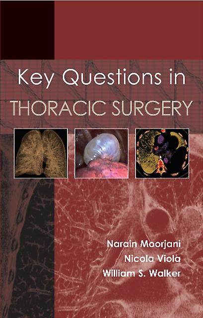 Key Questions In Thoracic Surgery by Dr William S Walker Paperback