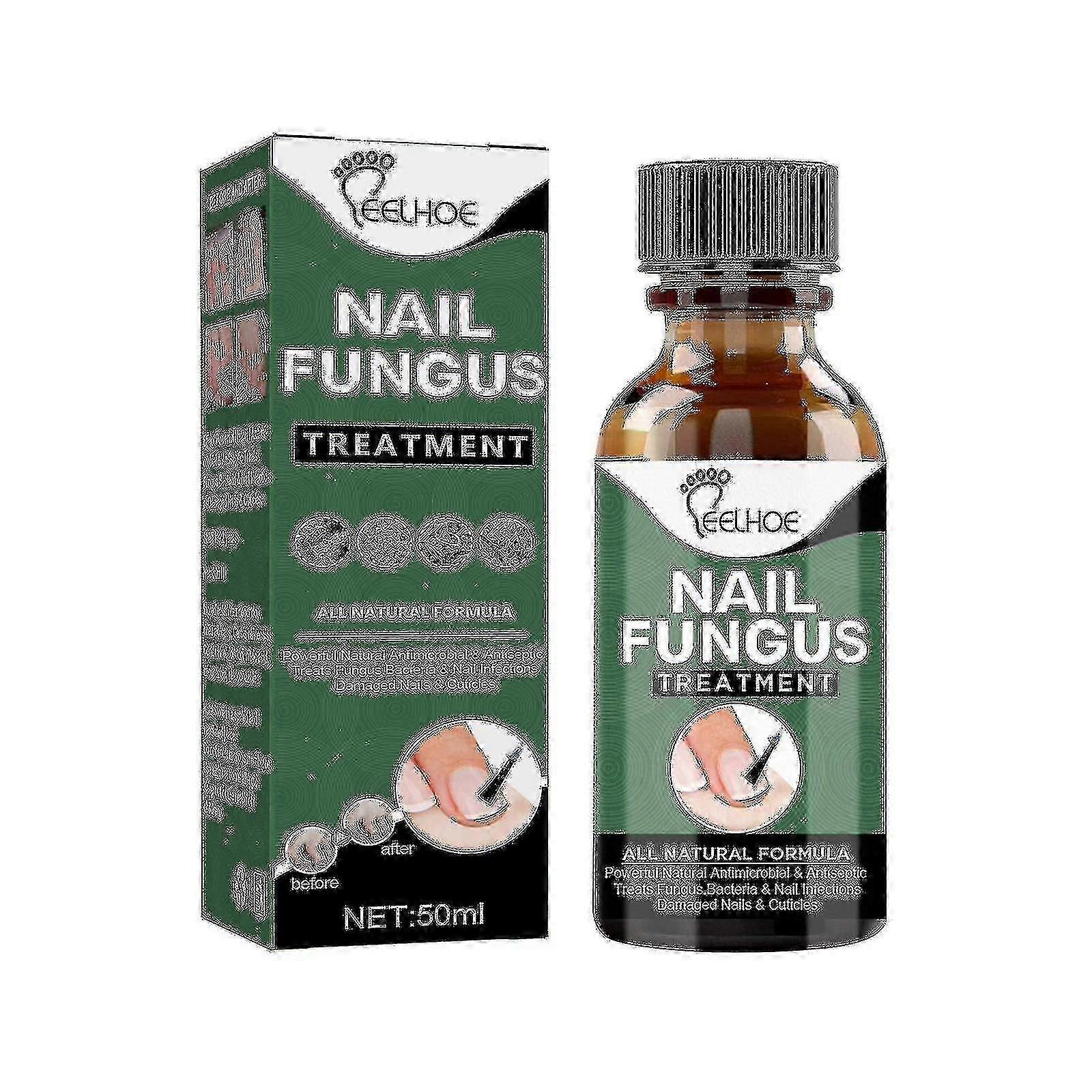 Traitement des champignons, Stop Effectiv TW 30ml 1