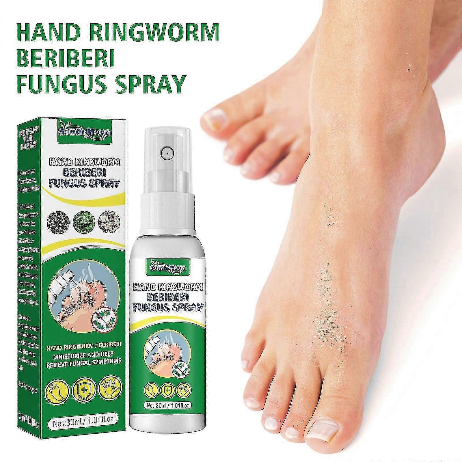 El ve Ayak Spreyi, Sporcu Ayağı Deodorant, Kaşıntı Önleyici, Çatlamış Cilt Onarımı El Ve Ayak Sprey Losyonu ve Moi