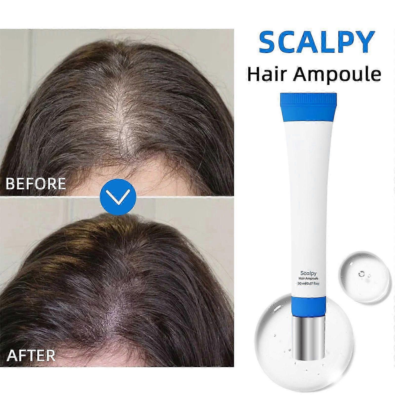 Scalp Treatment | Scalpy Hair Growth Serum for Hair Loss & Thinning | Strengthen Roots & Exfoliate Dandruff & Sooth Itch | Non-Greasy, Lightweight