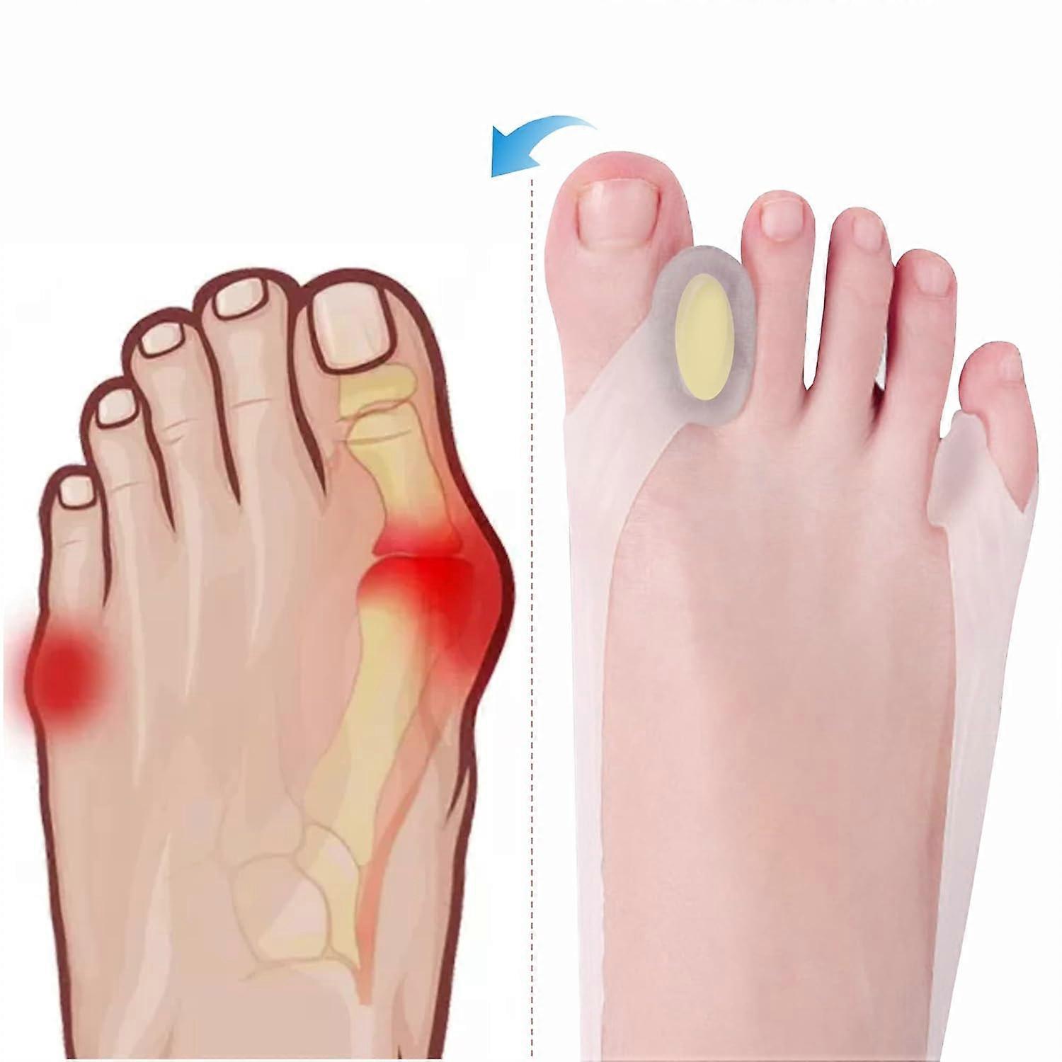 8pcs New Generation Toe Separator Toe Corrector Toe spacers for Women And Men can be Adjusted can be Worn Shoes