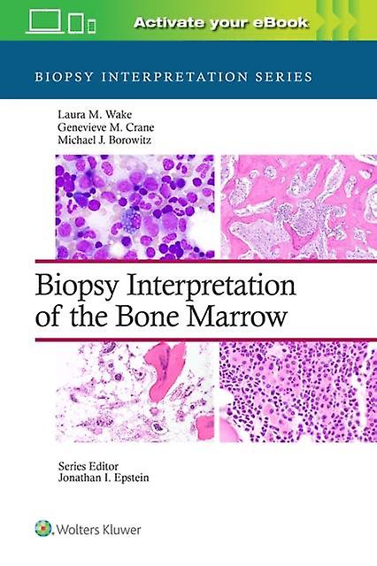 Biopsy Interpretation Of The Bone Marrow Print book With Multimedia by Borowitz & Michael Joseph & MD & PhD Paperback Book