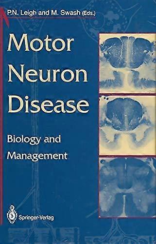Motor Neuron Disease Paperback