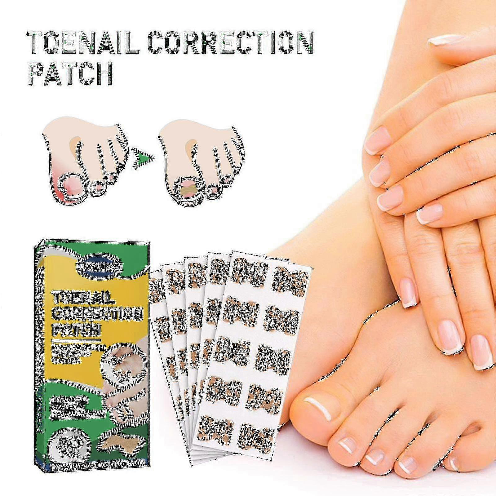 Pt Jaysuing Toenail Patch Corretor de Unhas Reparação de Unhas Internas