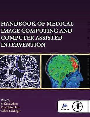 Handbook of Medical Image Computing and Computer Assisted Intervention
