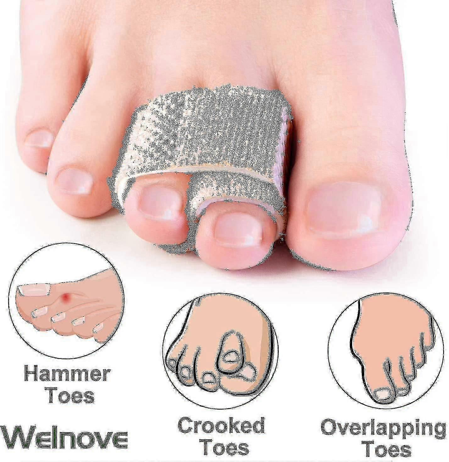 8-Piece Hammer Toe Straighteners for Comfortable Toe Alignment