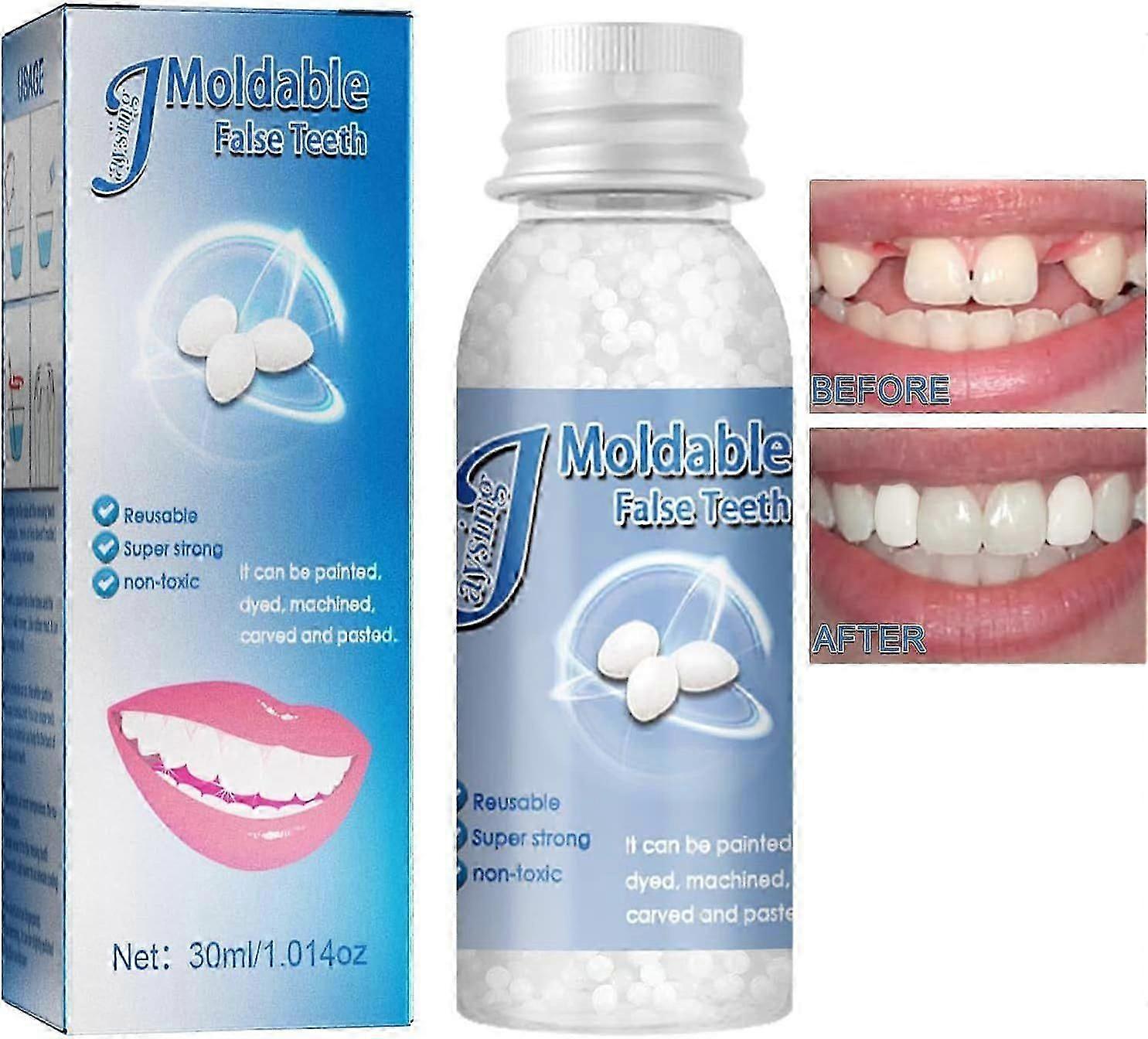 Temporary Tooth Repair Kit with Moldable Beads for Fixing Missing and Broken Teeth - DIY Dental Filling Granules