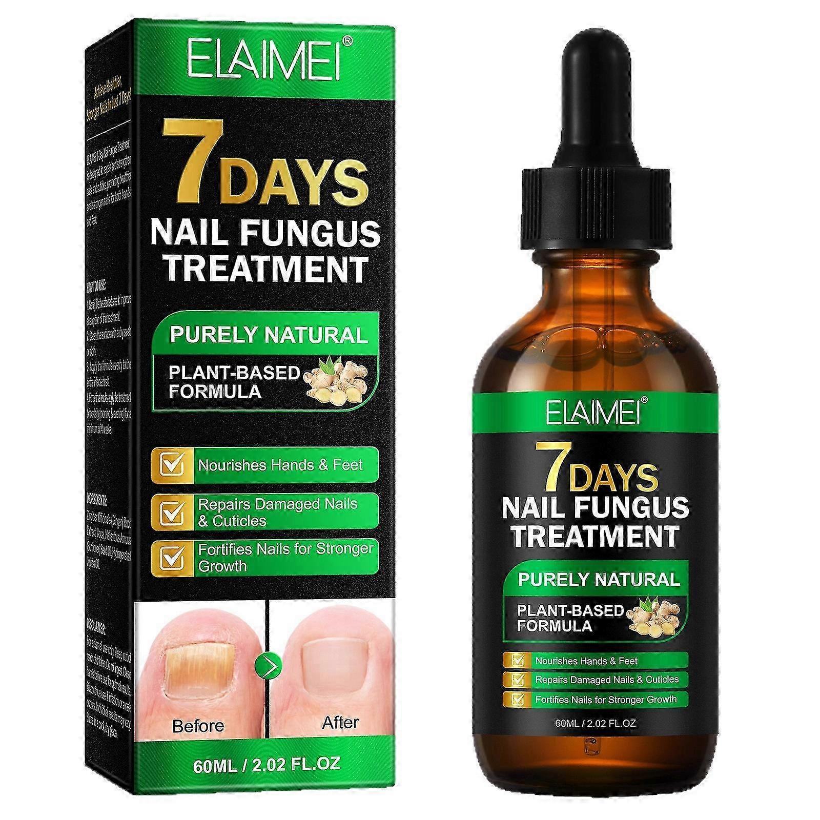 Tånagelsvamp Nagelbehandling Extra stark ingefära nagelbehandling Nagelstöd Nagelvård, Nagelbehandling, Nagelstärkande ingefära nageltillväxtserum