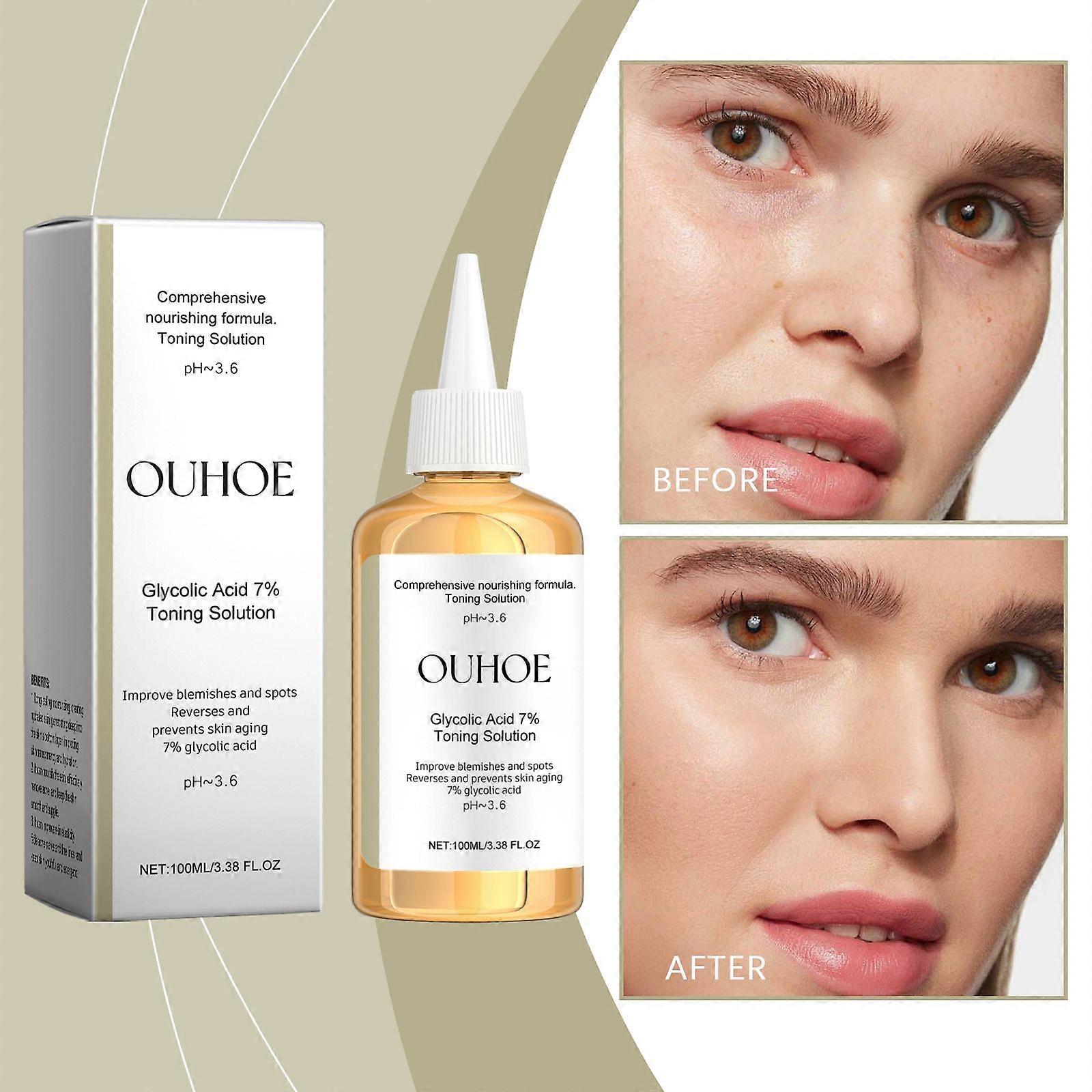 Ouhoe 7% Glycolic Acid Moisturizing Toner, An Essence For Removing Closed Comedones And Improving Skin Condition